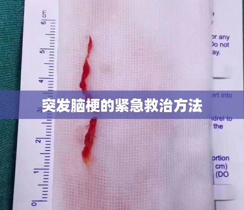 突发脑梗的紧急救治方法