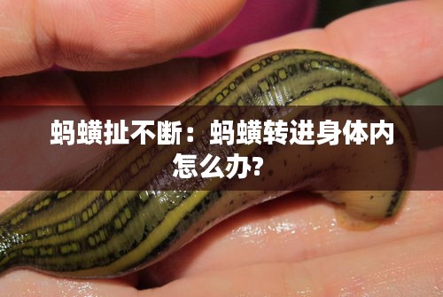蚂蟥扯不断：蚂蟥转进身体内怎么办? 