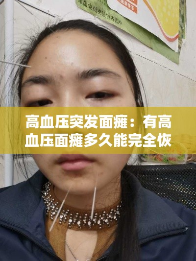 高血压突发面瘫:有高血压面瘫多久能完全恢复