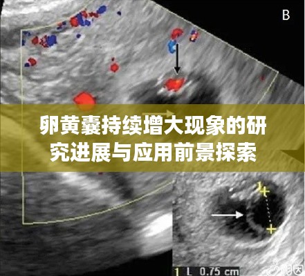卵黄囊持续增大现象的研究进展与应用前景探索